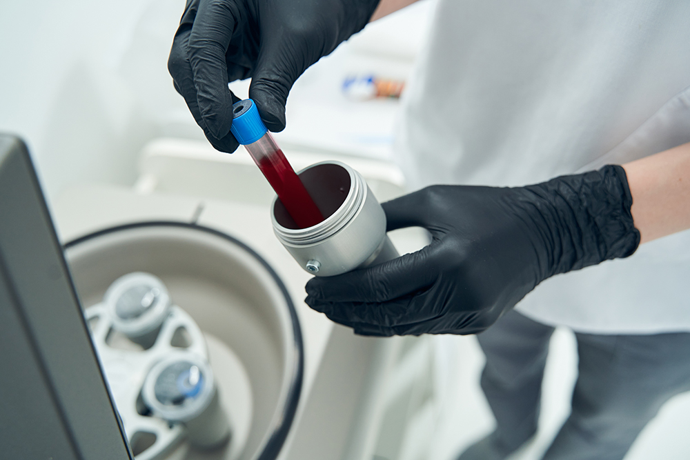 hormone blood work
